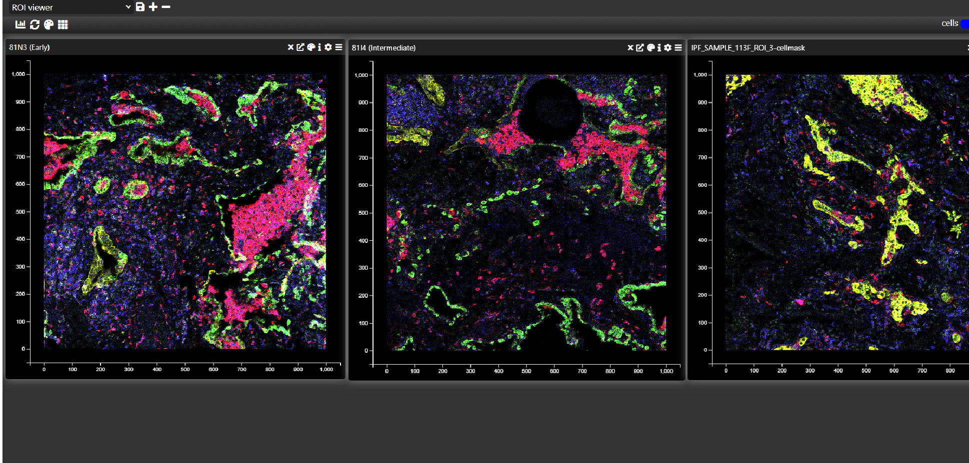 Spatial Image Analysis
